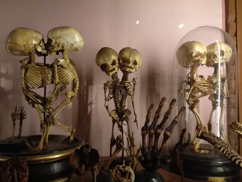 Human skeletons on display at the Museo Anatomico di Napoli in Naples, Italy, arranged in glass cases as part of the museum’s historical collection of medical and anatomical specimens.